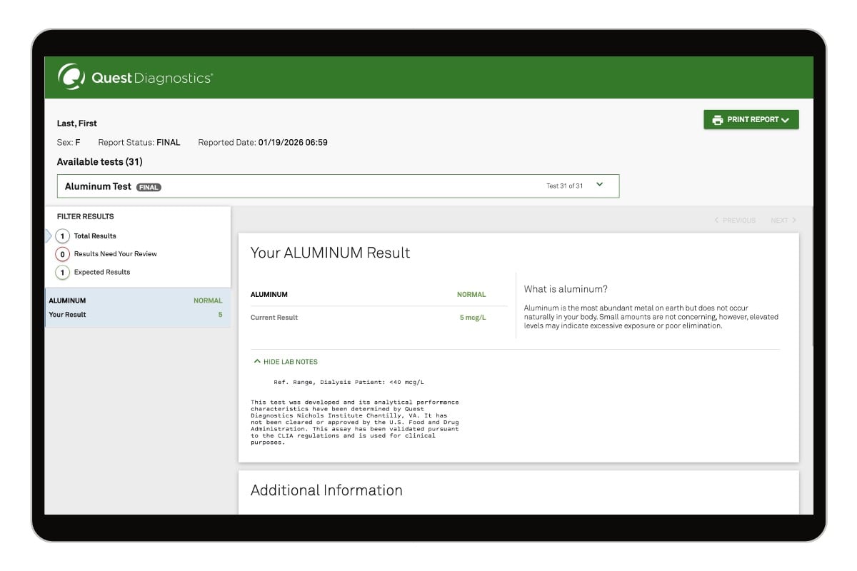 Aluminum Test image number 0