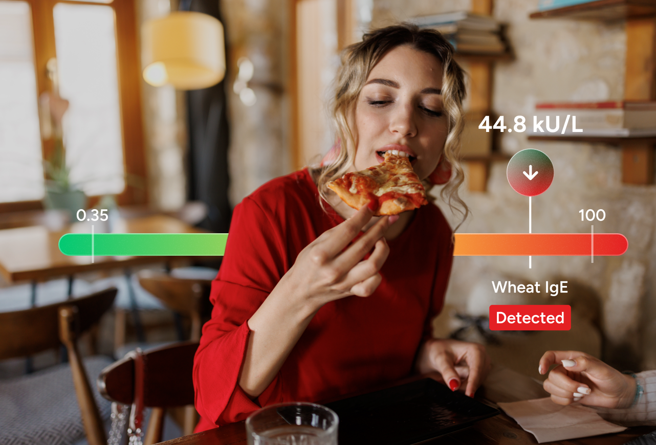 Food Allergy Panel with Reflex to Components number 2