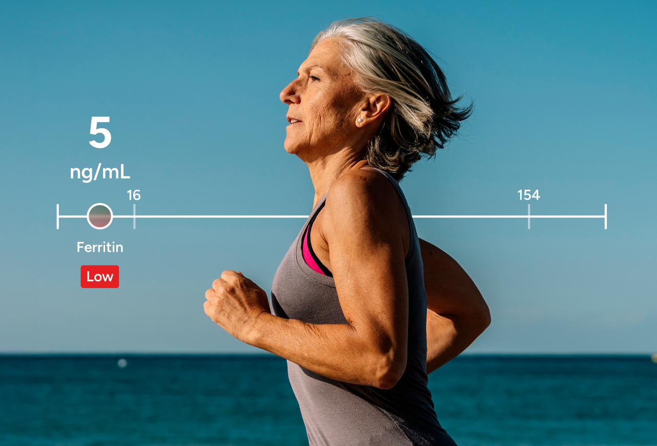 Iron, TIBC & Ferritin Panel number 2