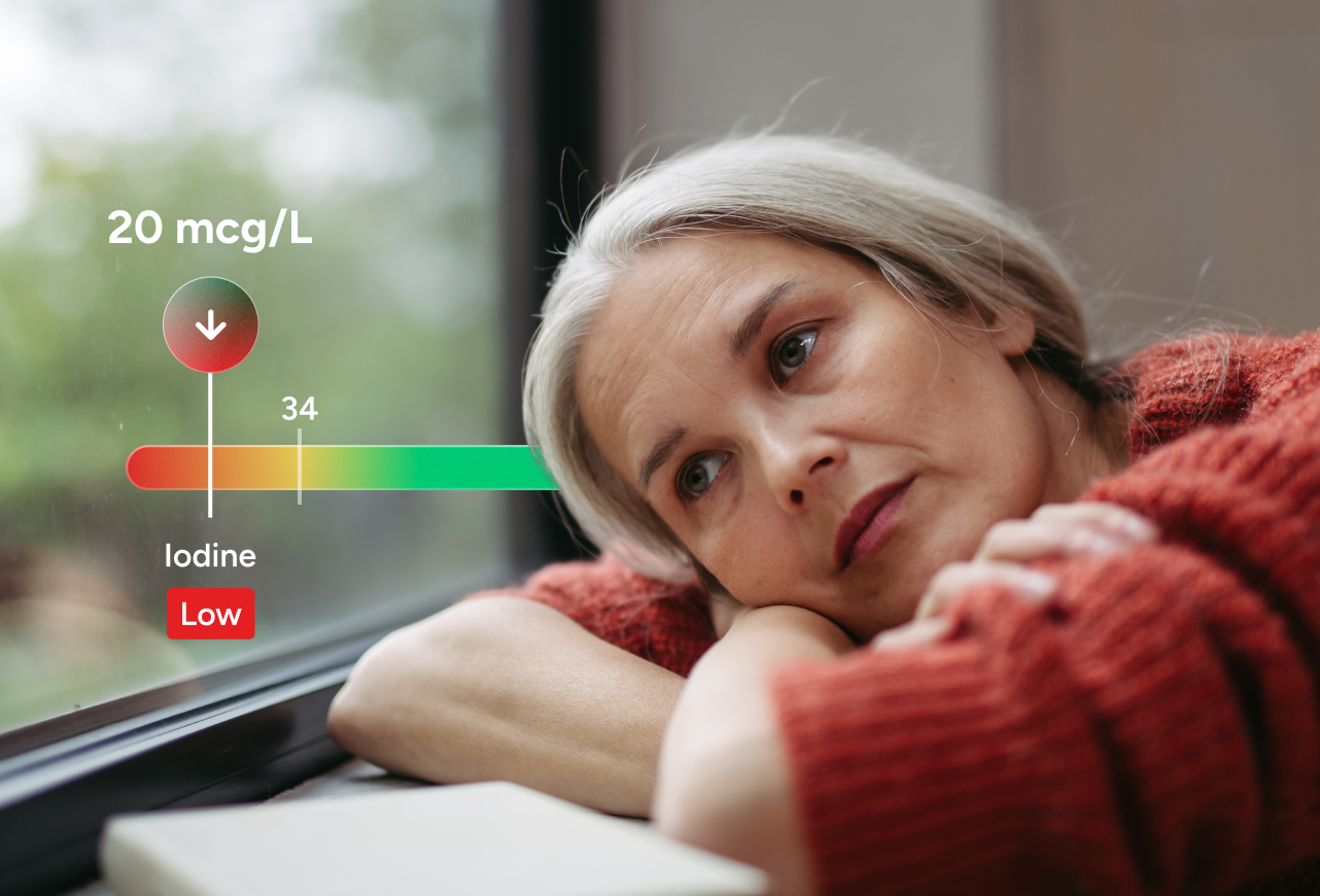 Iodine Test number 2