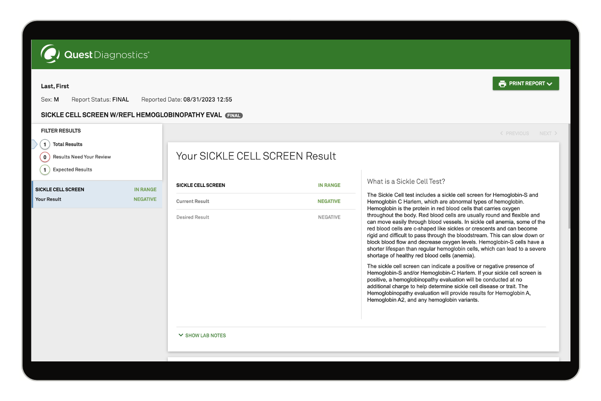 Sickle Cell Trait Screen Test with Reflex image number 0