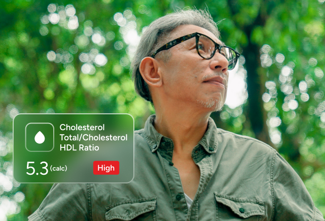 Cholesterol (Lipid) Panel number 2