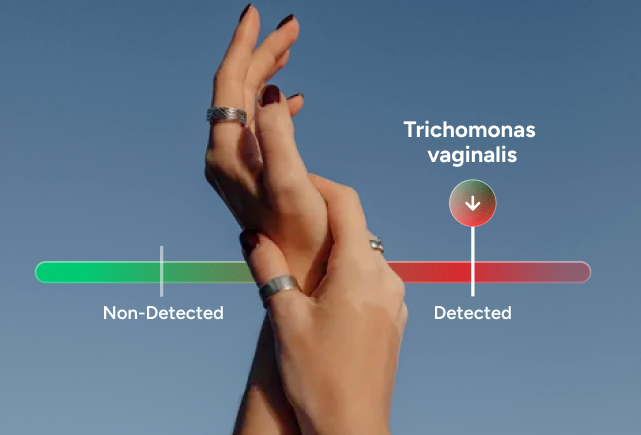Trichomoniasis Test number 2