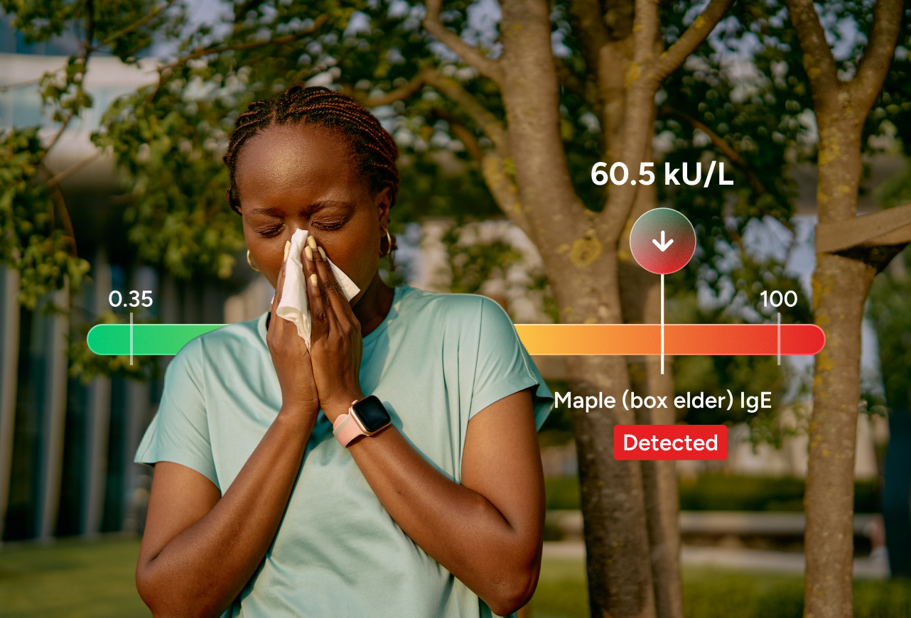 Tree Pollen Respiratory Allergy Panel number 2