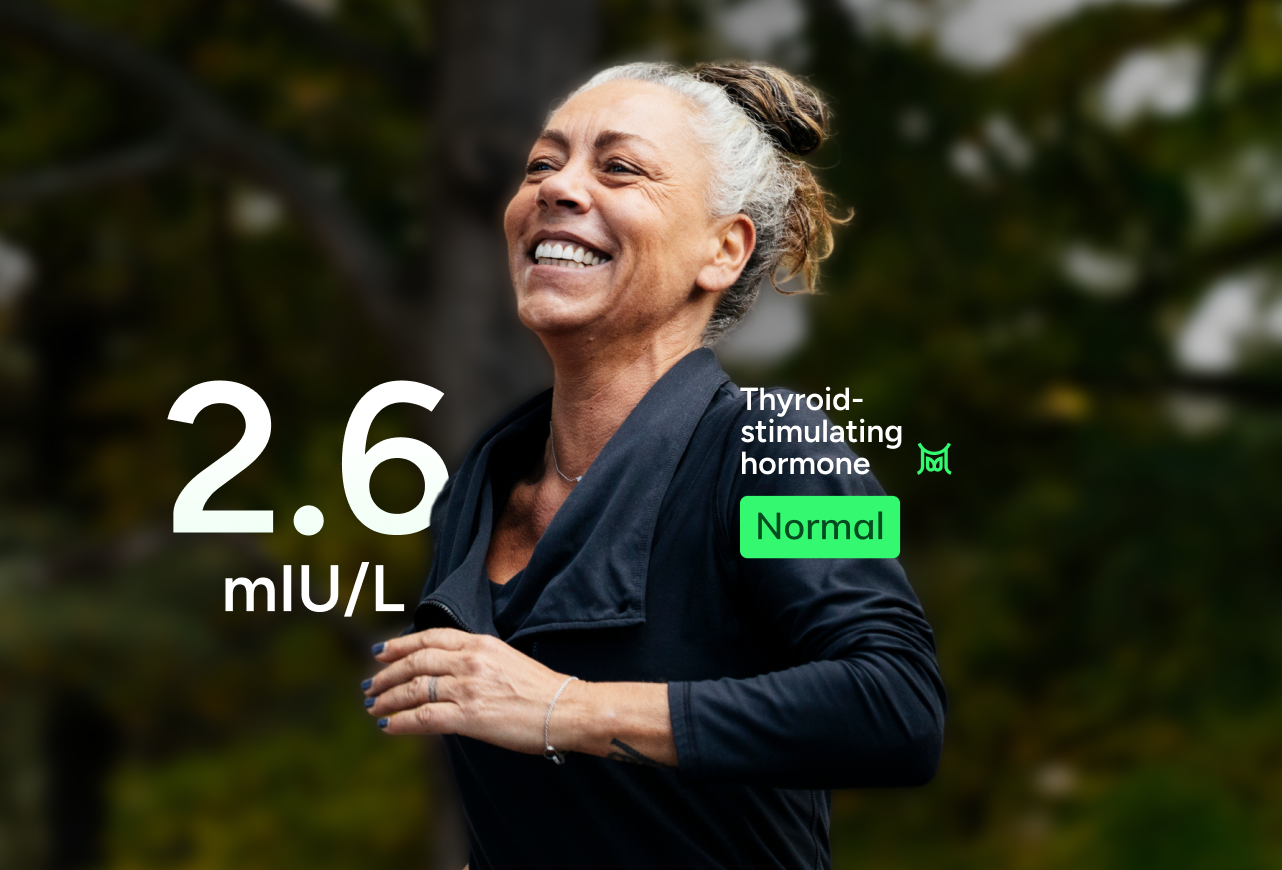 Thyroid TSH Function Test number 2