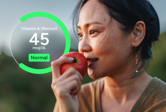 Milk Allergy Nutrient Deficiency Test Panel number 2