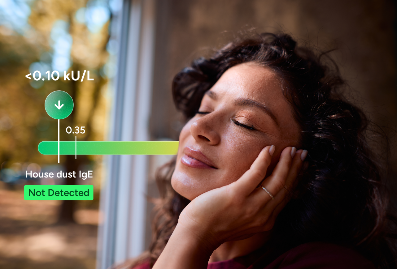 Indoor Respiratory Allergy Panel number 2