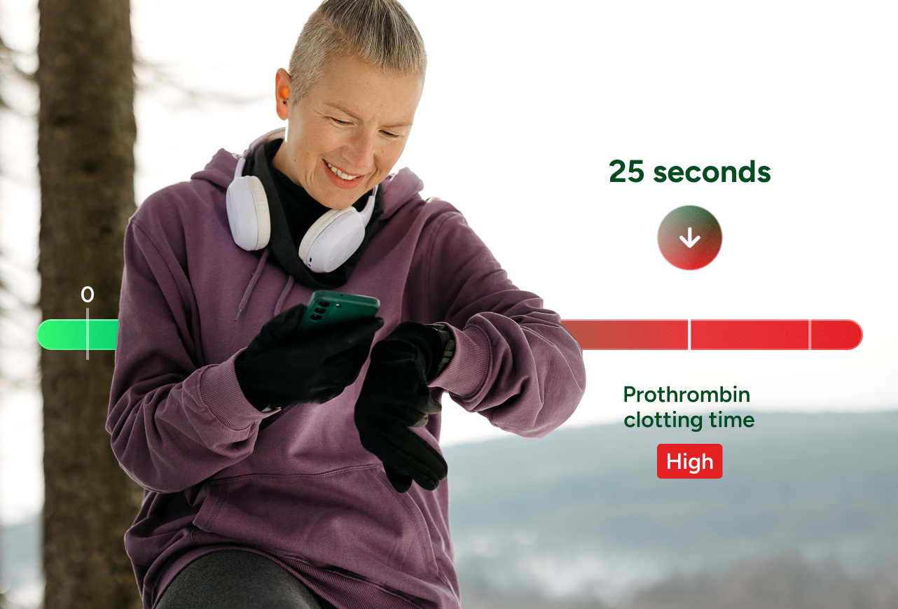 Prothrombin Time with INR Test number 2