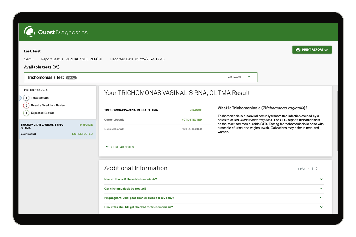 Trichomoniasis Test image number 0