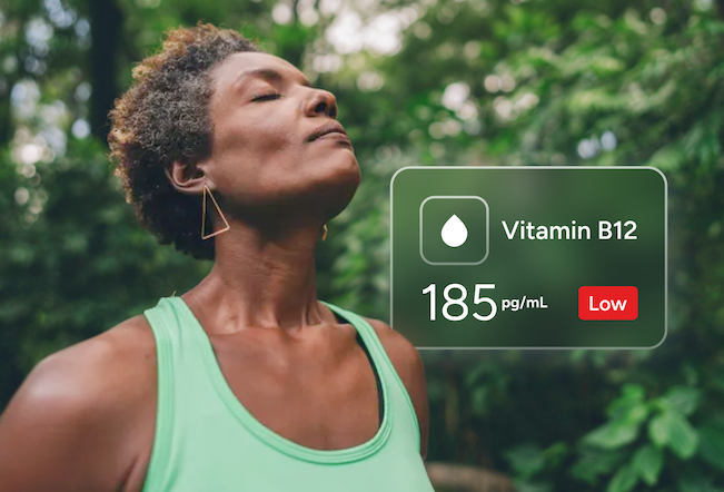 Vitamin B12 Test number 2