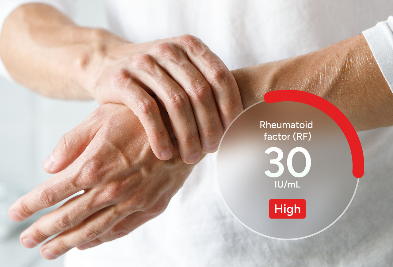 Rheumatoid Arthritis Test Panel number 2