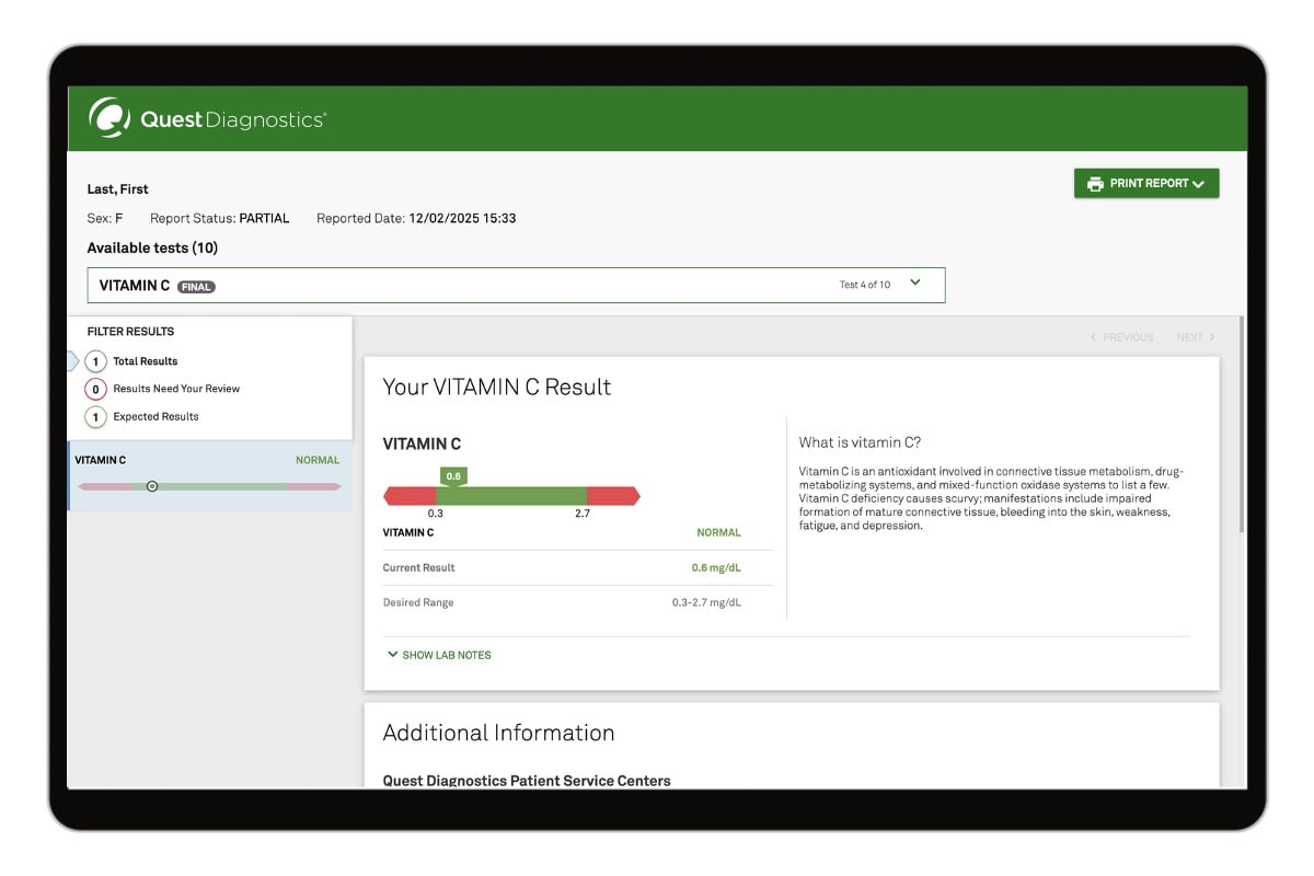 Vitamin C Test image number 0