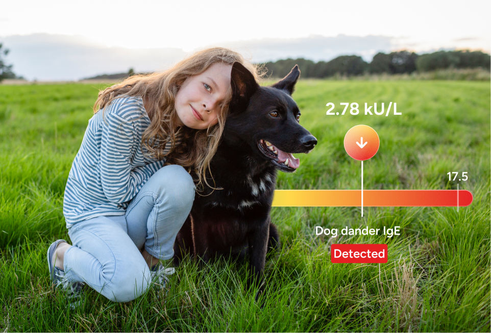 Childhood Allergy Test Panel number 2