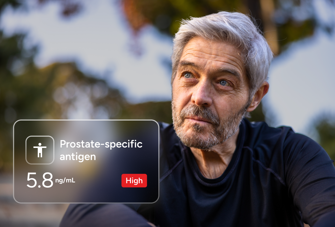 Prostate Screening (PSA) number 2