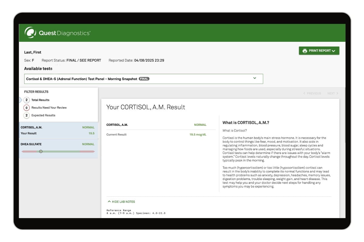 Cortisol & DHEA-S (Adrenal Function) Test Panel &mdash; Morning Snapshot