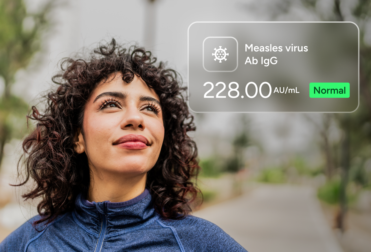 Measles, Mumps, Rubella (MMR) Antibody Test Panel number 2