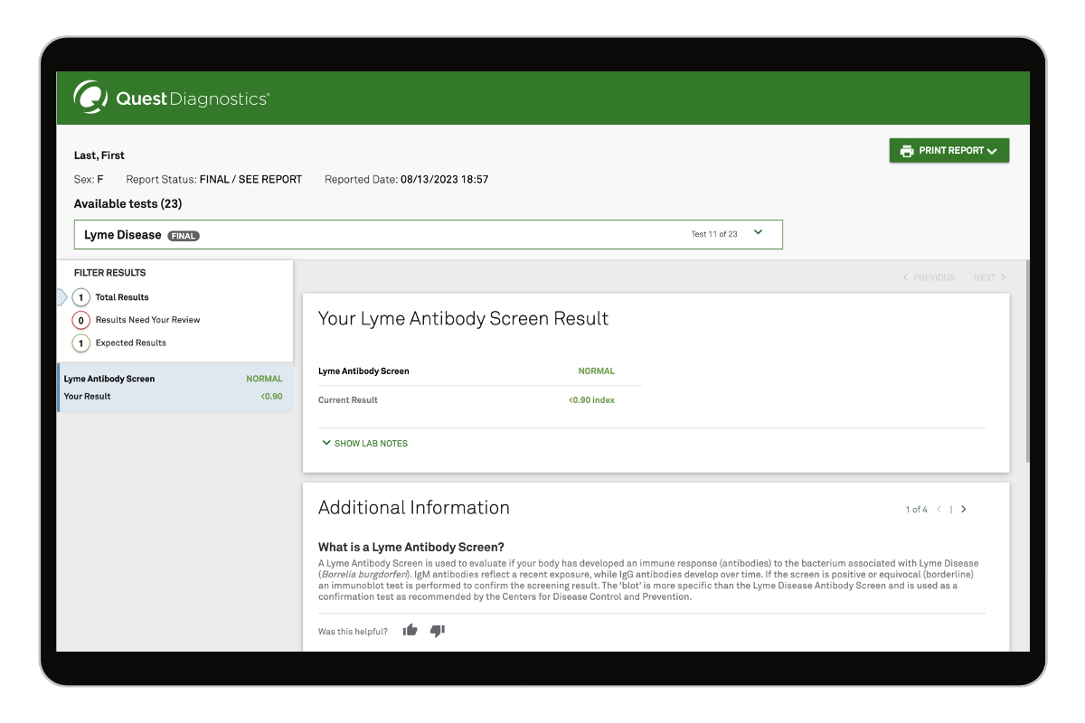 Lyme Disease Test With Confirmation image number 0