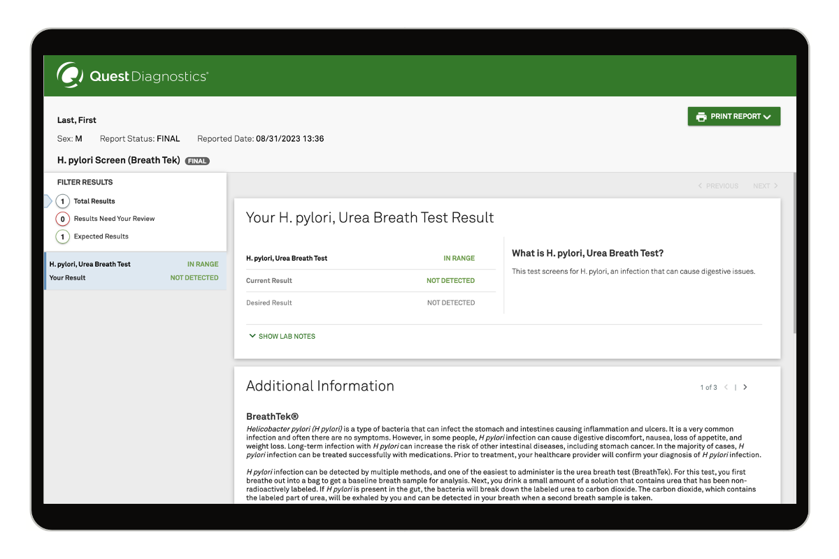 H. pylori Breath Test image number 0