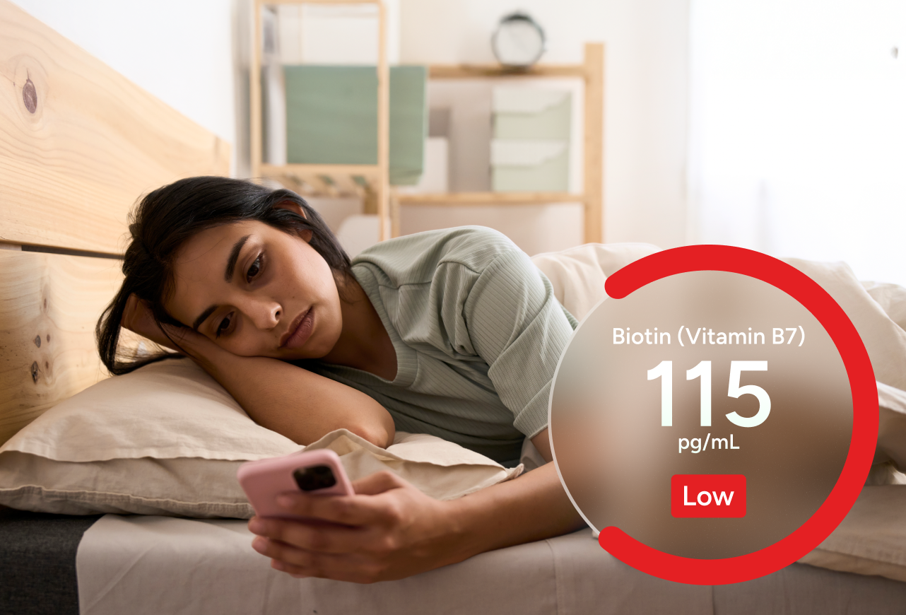 Biotin (Vitamin B7) Test number 2