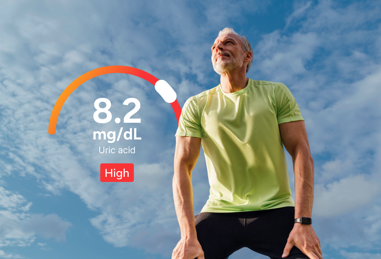 Gout (Uric Acid) Test number 2
